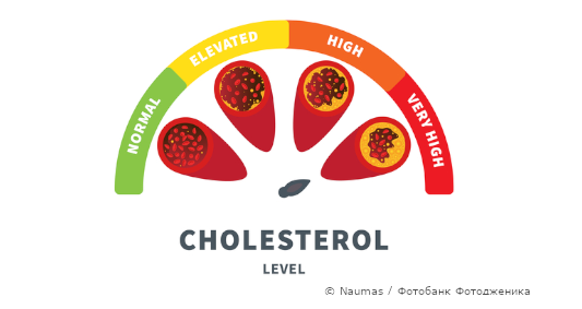 Холестерин (холестерол): нарушения обмена и транспорта, развитие атеросклероза