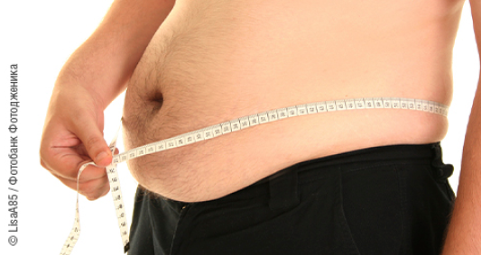 Абдоминальное ожирение (центральное, висцеральное ожирение, ожирение по типу «яблоко»)