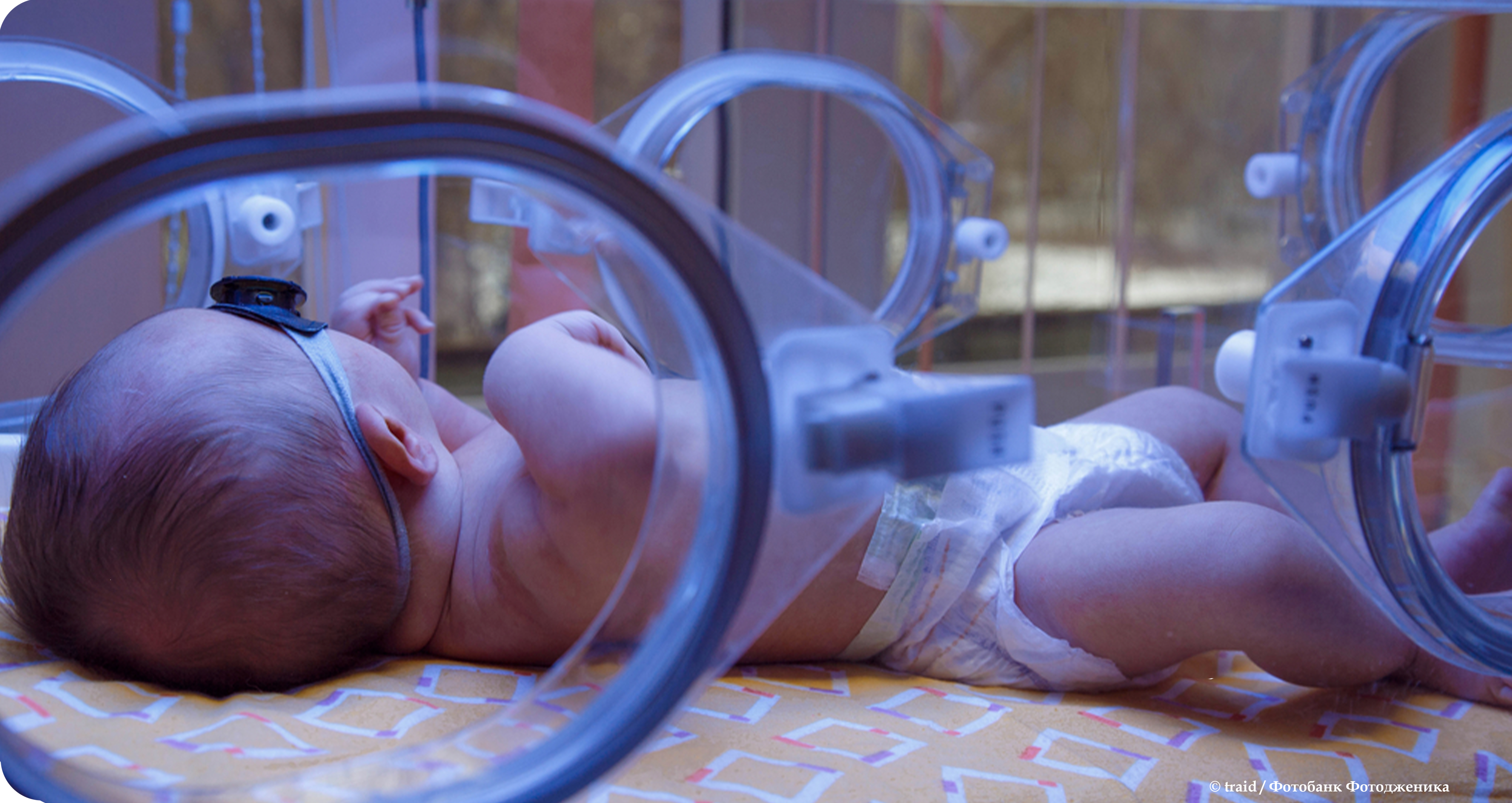 Физиологическая желтуха новорожденных: что это такое, когда стоит волноваться