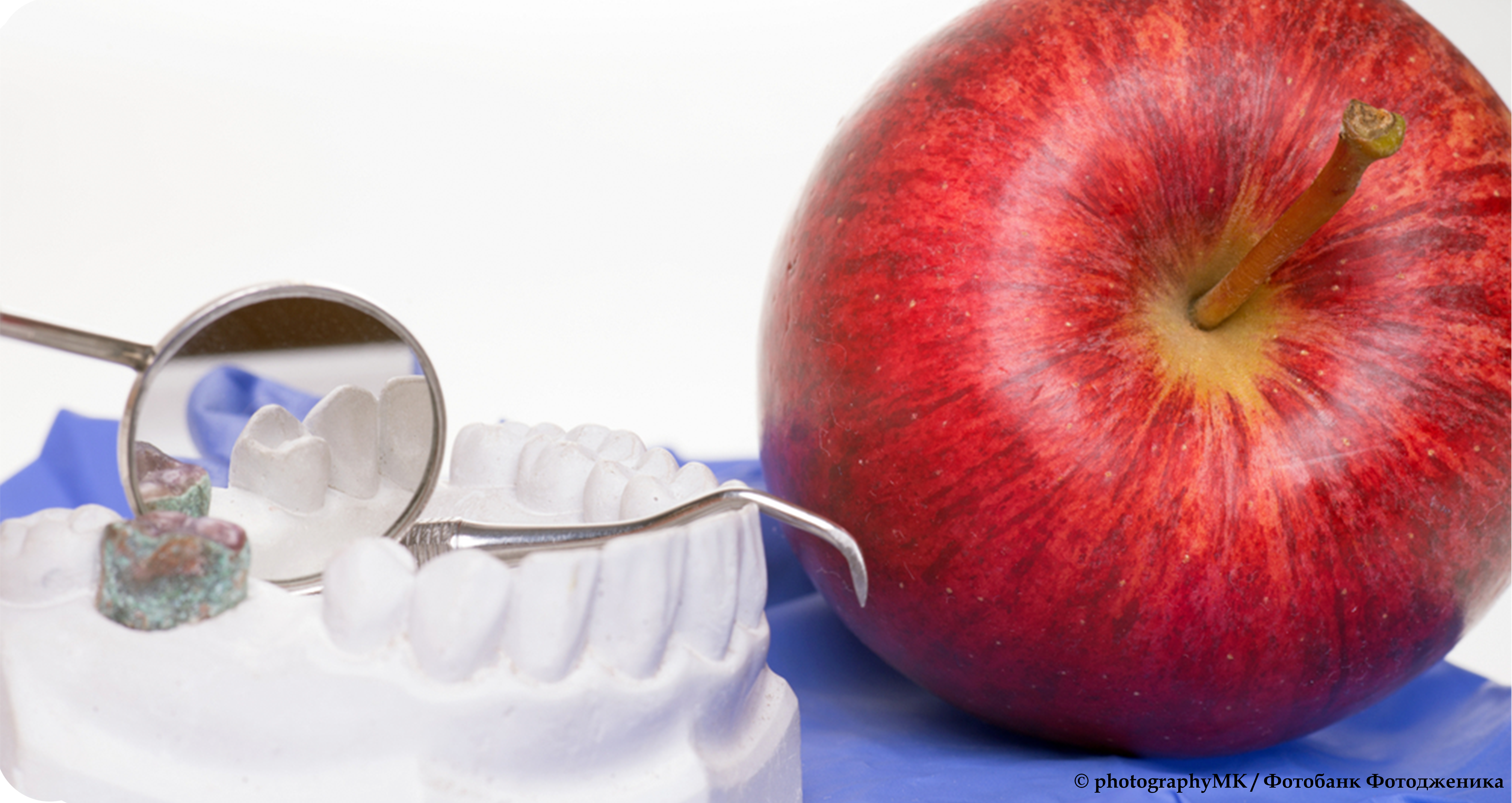 Пародонтоз: раннее выявление – сохранение зубов